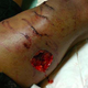 Image for article titled Norfolk State University Student Brutally Attacked by Police Dog